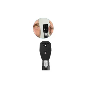 Ophthalmoscope | Direct Ophthalmoscope – Frago Impex